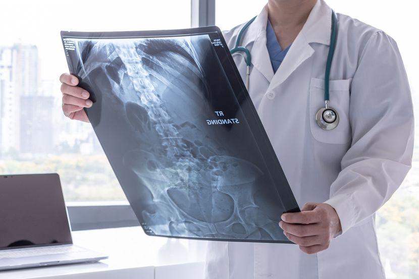 Отишол во болница со страшни болки- докторите се шокирале кога виделе што има во телото