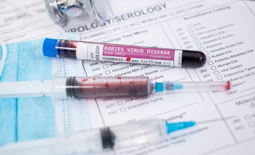 Американец починал од беснило, се заразил на страшен начин