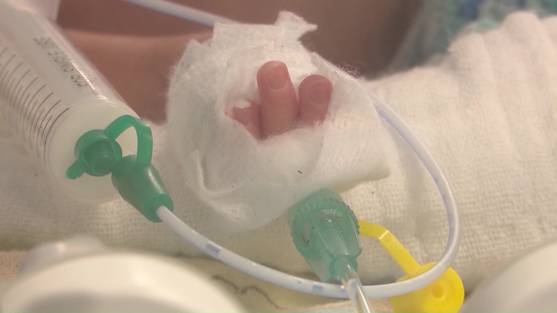 Обдукцијата ја утврди причината за смртта на новороденчето