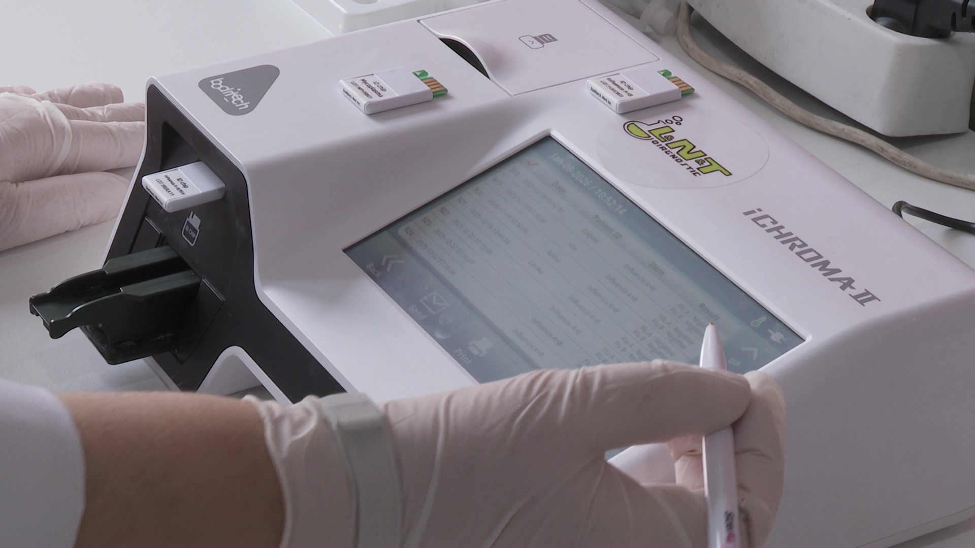 35% од испитаните деца во Детската болница Козле имале грип