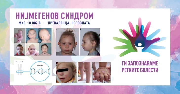 „Ги запознаваме ретките болести“: Нијмегенов синдром на раскинување/Нијмегенов синдром на кршење