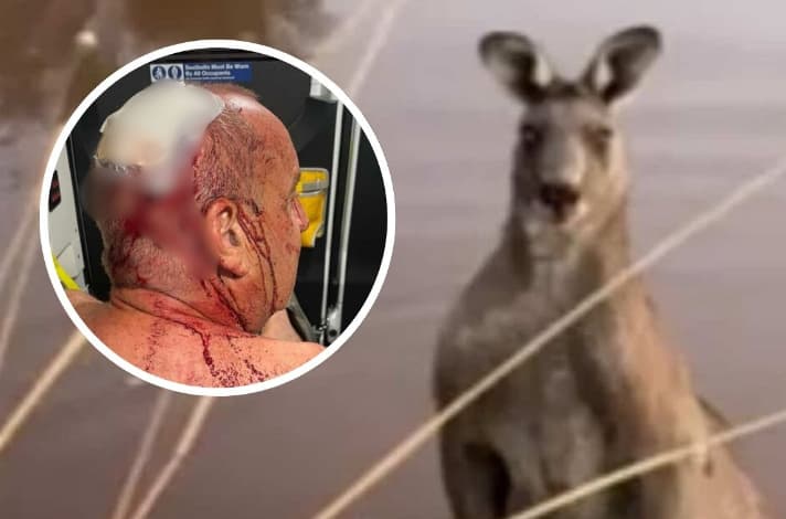 Кенгур брутално претепа човек: Му се нафрли на кучето, а потоа ме удри по лицето (ВИДЕО)