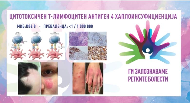„Ги запознаваме ретките болести“: Цитотоксичен т-лимфоцитен антиген 4 хаплоинсуфициенција