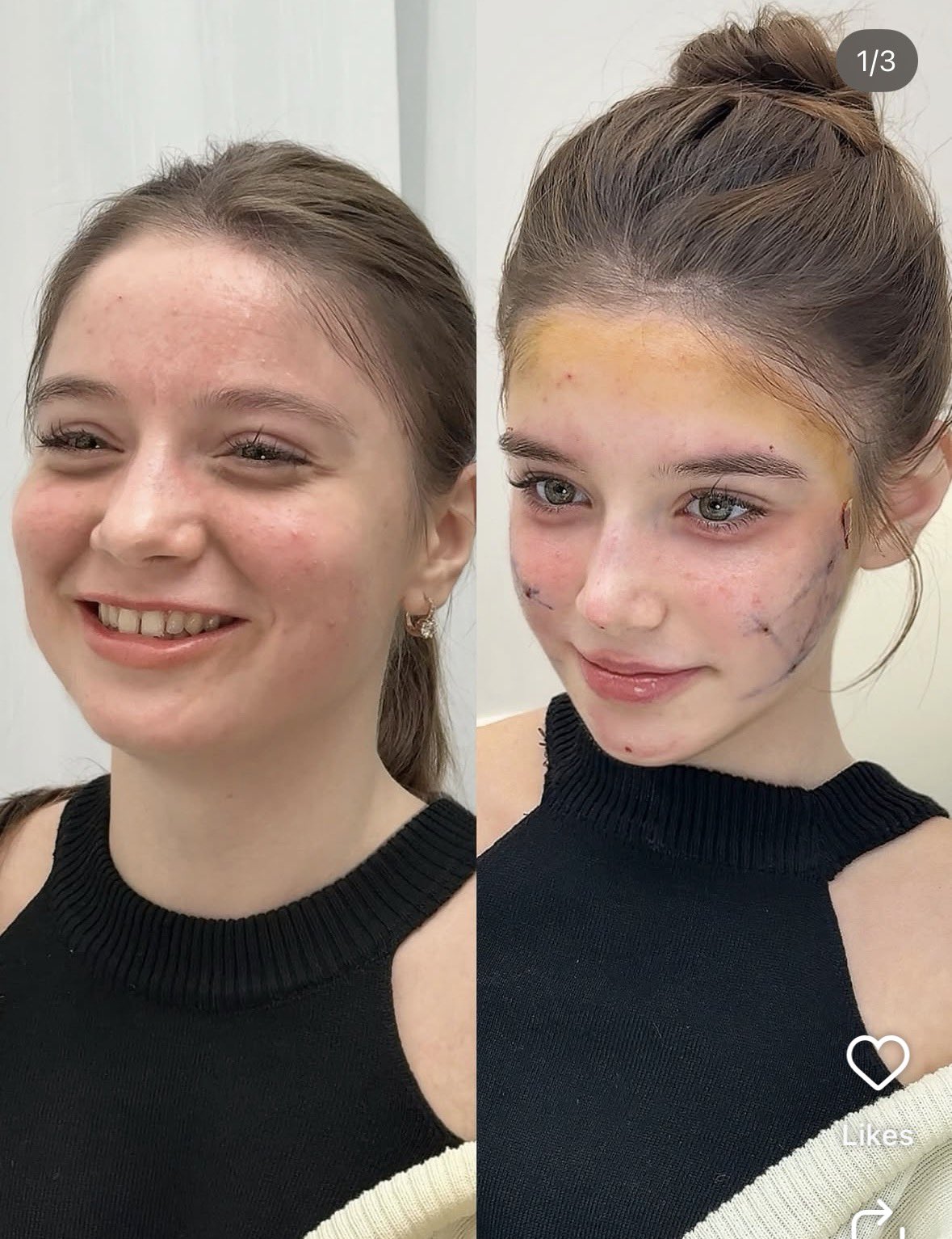 Жени масовно одат во Шангај за да се оперираат и да изгледаат како 13-годишни девојчиња!