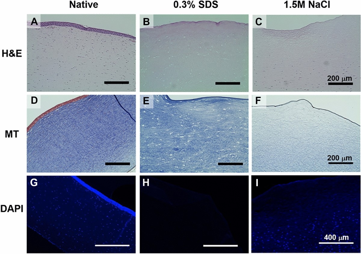 Македонски научници во Норвешка развиваат иновативна и 3Д-принтана рожница за трансплантација