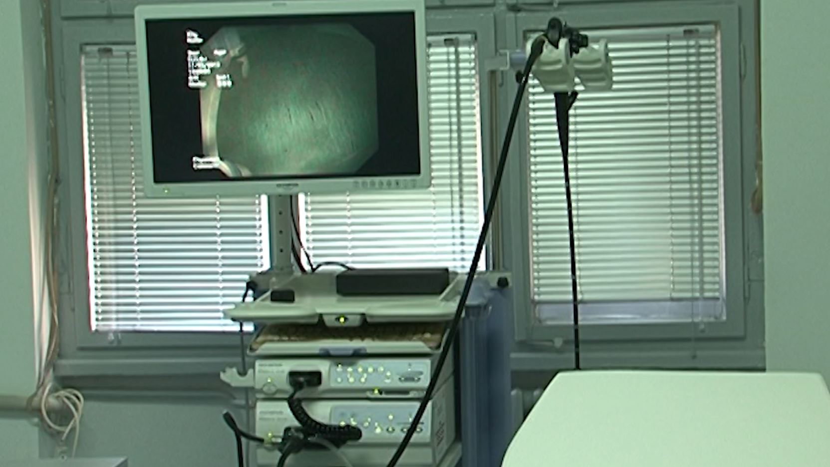 Ракот на дебелото црево сè почест кај помладите