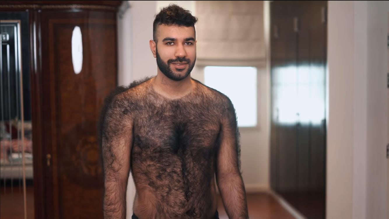 Највлакнестиот човек на светот?! Ова момче му ги покажа на целиот свет своите влакна, изгледа како волкодлак и на тоа се гордее!