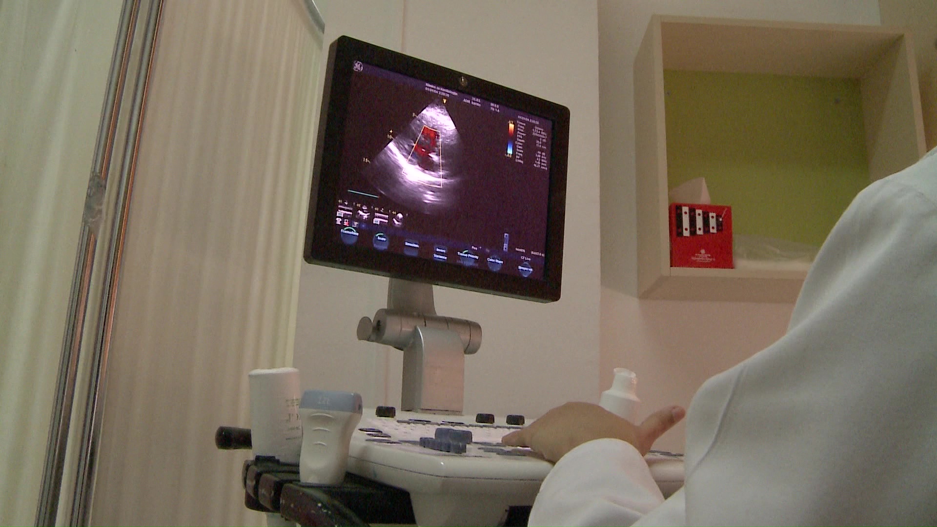 Сè помлади пациенти со сериозни срцеви заболувања – кардиолозите предупредуваат на алармантен тренд