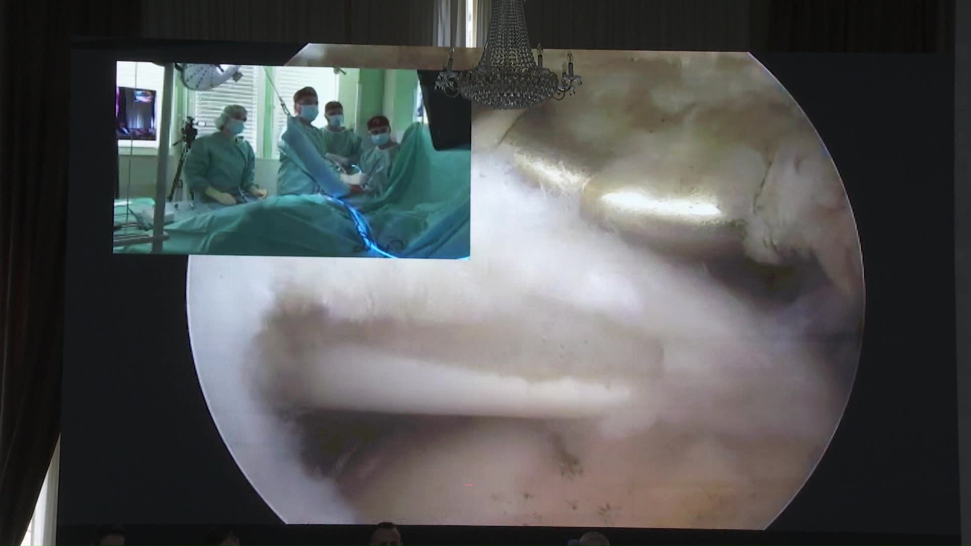 Иновации во „ГОБ 8 септември“: Виртуелна технологија за побрзо закрепнување на спортистите