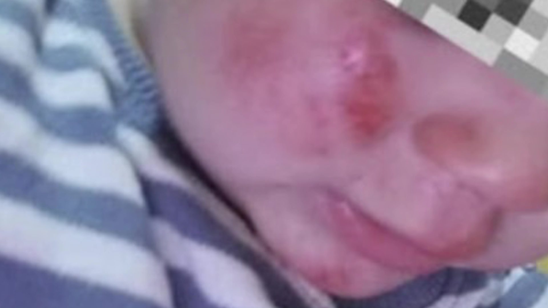 Хорор во кичевско Другово - ротвајлери нападнале мајка со две деца, едното завршило со телесни повреди