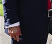 Трамп оди на лекарски преглед, негови фотографии со модринки се шират на интернет