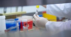 Истражување: Научници открија начин да го сопрат растот на клетките на ракот на дебело црево