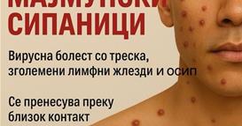 Мајмунски сипаници во Македонија - епидемиологот Даниловски вели дека не се пренесуваат лесно 