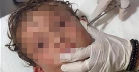 Кошмар за секој родител: Докторите вадат жив рак од уво на мало дете (ВИДЕО)