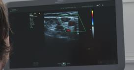 Годишно во Македонија има по пет илјади мозочни удари – не се поштедени ниту децата