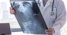 Отишол во болница со страшни болки- докторите се шокирале кога виделе што има во телото  