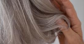 Истражување: Седата коса е природна заштита против меланом