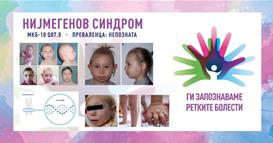 „Ги запознаваме ретките болести“: Нијмегенов синдром на раскинување/Нијмегенов синдром на кршење