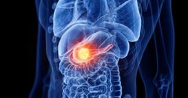 Ракот на панкреасот го користи нервниот систем за својот раст- новото истражување откри чудна врска 