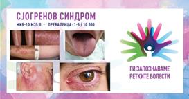 „Ги запознаваме ретките болести“: Сјогренов синдром
