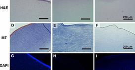 Македонски научници во Норвешка развиваат иновативна и 3Д-принтана рожница за трансплантација