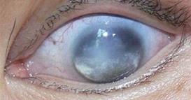 Првпат во историјата: Вирус од морски животни премина на луѓе и предизвикува сериозни проблеми со видот