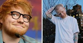 Ед Ширан си ја избричи главата и ја откри причината: Се борам со херпес, тоа никому не би го посакал 