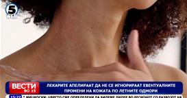 Лекарите апелираат да не се игнорираат евентуалните промени на кожата по летните одмори