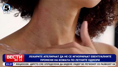 Лекарите апелираат да не се игнорираат евентуалните промени на кожата по летните одмори
