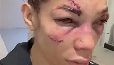 Софија Монтенегро е непрепознатлива по борбата во Париз (Вознемирувачко видео) 