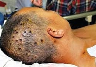 Наезда на стршлени во Србија - старица искасана сто пати