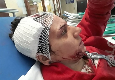 Хрватска ријалити ѕвезда со секира била нападната од соседот 