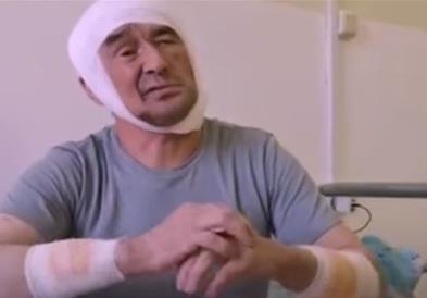 Преживеал напад на поларна мечка: Морав да молчам додека ме гризеше (ВИДЕО)