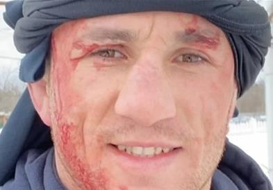 УФЦ борец се фрли во замрзнато езеро и заврши во болница (ВИДЕО)