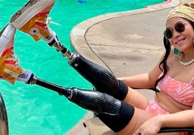 Ги изгубила нозете кога родителите и се разнеле со бомба, сега е параолимпијка и манекенка 