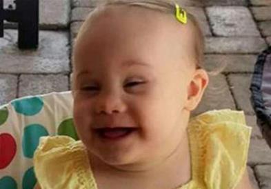 Родители занемариле 4-годишно девојче со Даунов синдром