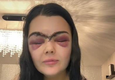 Девојка џокеј се шокирала од својот одраз во огледало по бизарната несреќа