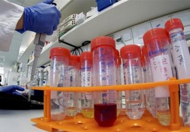 Србија: 44 починати, 2130 новозаболени 