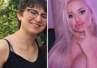 Што мислите колку операции имала оваа жена?