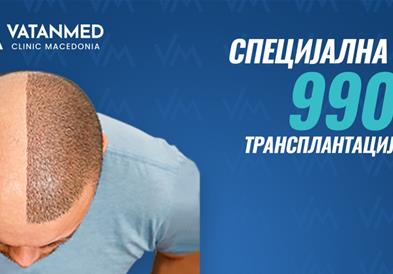 Трансплантација на коса по супер цена од 990 евра