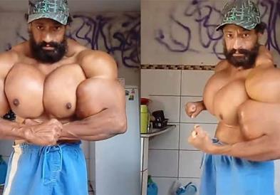 Почина „Бразилскиот Хулк”, ги пумпал мускулите со отровни инекции (ФОТО)