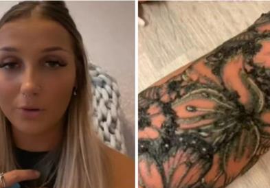Совршена тетоважа се претворила во „пекол“ поради алергиска реакција на мастило!