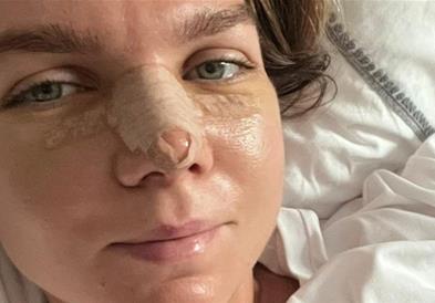 Врвна тенисерка го оперира носот и ги пропушта натпреварите, претходно „ги среди“ градите 