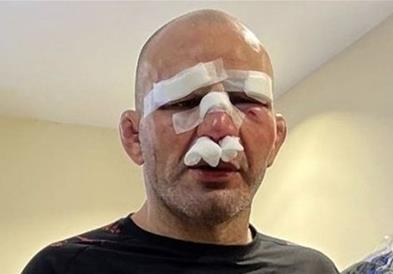 Менаџер на борец, претепан на натпревар: Не му е ништо 