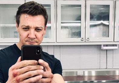 Џереми Ренер покажа како се опоравува по несреќата, во која му се скршени 30 коски (ВИДЕО)