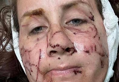 Видра нападна три Американки во река, претрпеле страшни повреди (ВИДЕО)