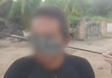 Случајно си пукнал со харпун во главата- му поминал низ черепот и мозокот: Имав среќа 