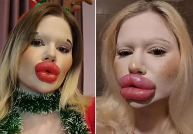 Бугарка има најголеми усни на светот, но не сака да запре (ВИДЕО)