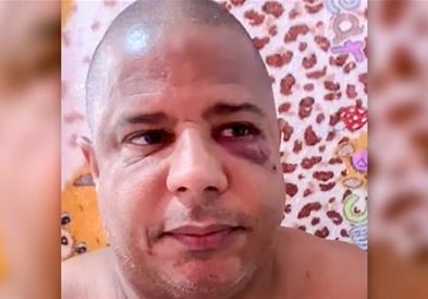Поранешен бразилски репрезентативец бил киднапиран со сопругата: Мислев дека ќе нѐ убијат 