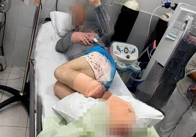 Ајкула изгризала турист, доедека се одморал на Малдивите (ФОТО)